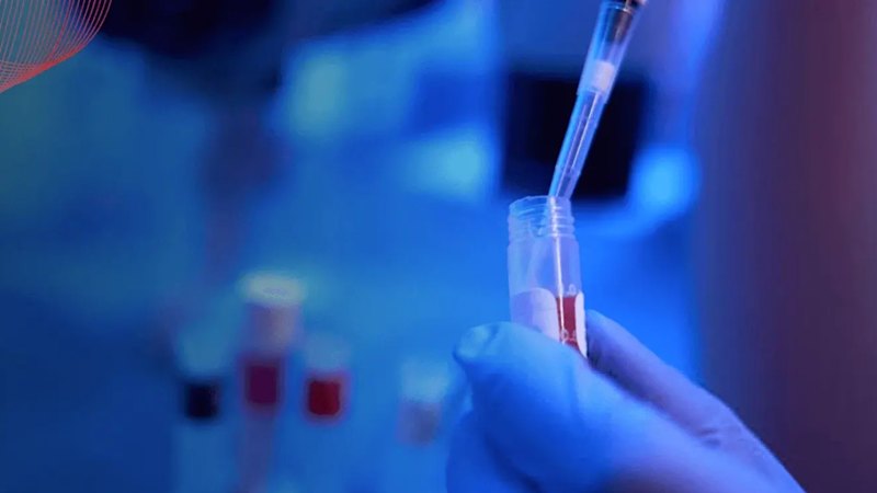 Proteomics diabetes test reshapes how doctors manage kidney risk