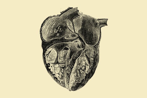 There were 125 heart transplants in Australia in 2025.