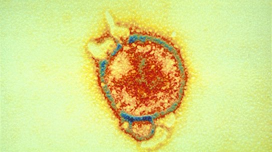 Hendra virus spilled into humans and horses from fruit bats.