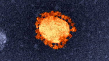 An electron-microscope image of the COVID-19 virus, isolated from the first Australian coronavirus case. Note the bubble in the centre surrounded by spikes.