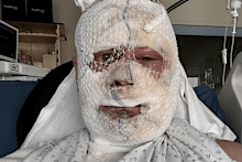 A Sydney man had discussed separating with his partner just hours before he allegedly scalded him with boiling water and beat him with a saucepan at a luxury French chateau.