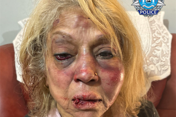 Ninette Simons was savagely assaulted successful  her home.