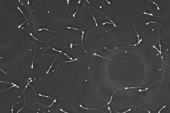 A new study has found reduced sperm production and testosterone in mice exposed to forever chemicals.