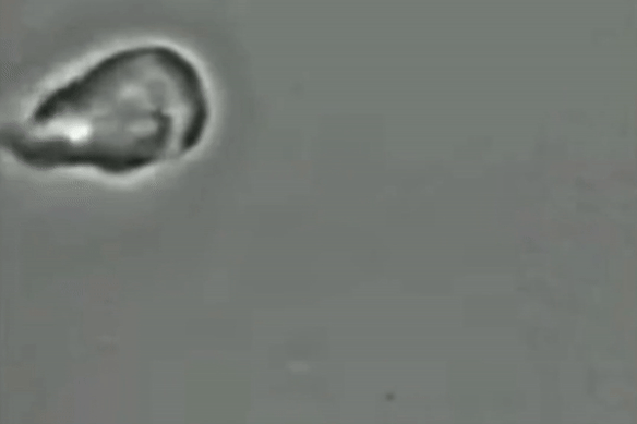 For decades, scientists have been unsure if the giardia parasite reproduces sexually or asexually.