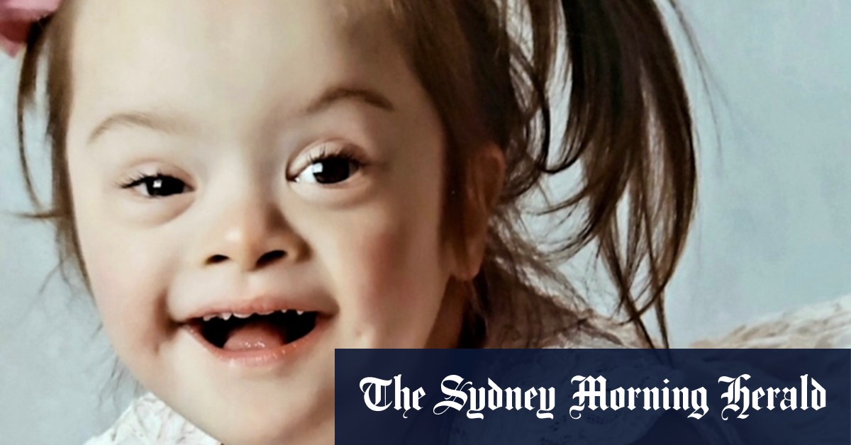 Victorian coroner found Dio Kemp’s death could have been prevented if medical staff investigated her symptoms more thoroughly