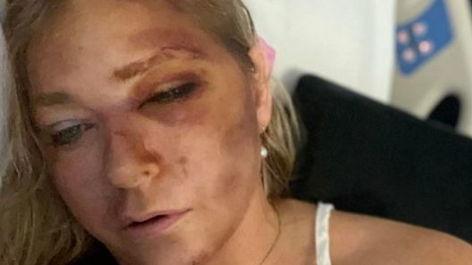 Guiffre posted this image to her Instagram claiming she was suffering from kidney failure and had just days to live.