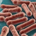 Australia's worst outbreak of diphtheria in decades has spread into three states after crossing the border from the Northern Territory.