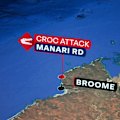 A man is recovering in hospital after surgery following a crocodile attack at a popular camping spot north of Broome.