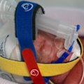 It's being considered one of the rarest births in the world, a Brisbane mother delivering identical quadruplet girls who were naturally conceived.