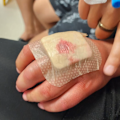 An 11-year-old boy suffered painful injuries after an alleged mistake at a Melbourne hospital left him worse off than when he arrived.