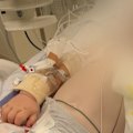 A Gold Coast toddler is in an induced coma after accidentally inhaling cake-decorating dust that turned into a toxic paste.