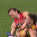 Essendon Bombers skipper Andy McGrath is led off the field before half-time after suffering a suspected broken jaw.
