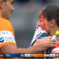 Wests Tigers hooker Salma Nour is forced from the field after a sickening head clash with teammate Sarah Togatuki.