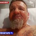 Randovan Banic was being treated in the spinal unit at the Prince of Wales hospital, when he was set alight by another patient. This man had attempted to set three other people alight.