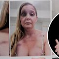 David Wells, an associate professor at Monash University’s department of forensic medicine, analysed photographs of Virginia Giuffre in the days after she alleged Robbie Giuffre assaulted her on a family holiday in 2025. In court documents, Robbie later accused Virginia of violence that night.
