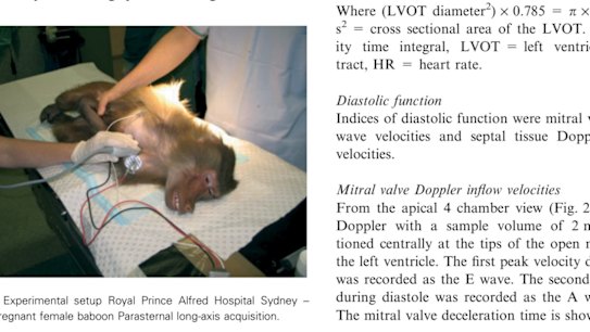 A baboon being experimented on at Royal Prince Alfred Hospital in Sydney. 