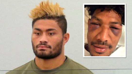 Photo shows brutal aftermath of alleged attack as Rebels duo fined $15,000