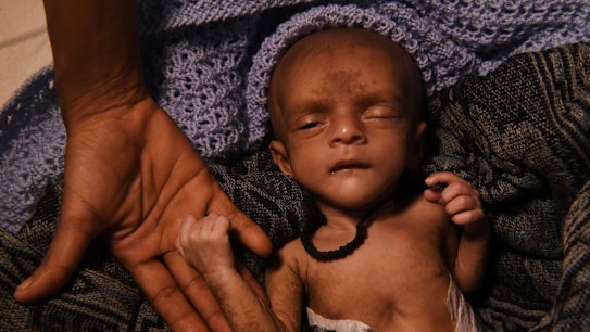 Ifran, a tiny malnourished baby, his heart struggling with every breath, lies on a stretcher in a Red Cross field hospital tent in south-eastern Bangladesh. 