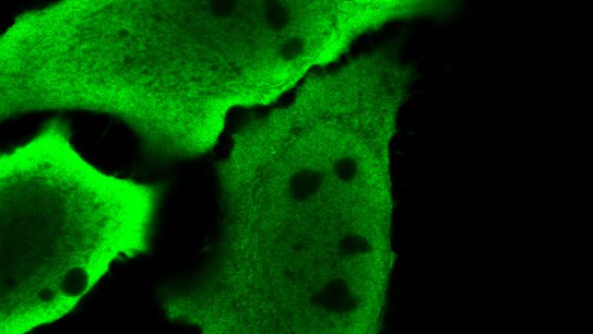 How vet Ben Cunneen’s tragic death inspired a scientific breakthrough