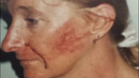 Wendy Lloyd was rushed to hospital after the attack in 2003.
