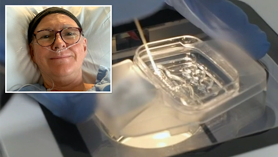 An expensive ovarian cancer drug that can prolong patients’ lives is being added to the PBS, making it more affordable.