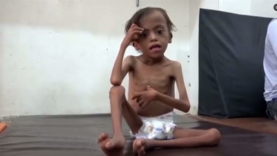 The UN says Yemen will face the world's worst famine in decades if the Saudi-led coalition refuses to lift its blockade on deliveries of aid.