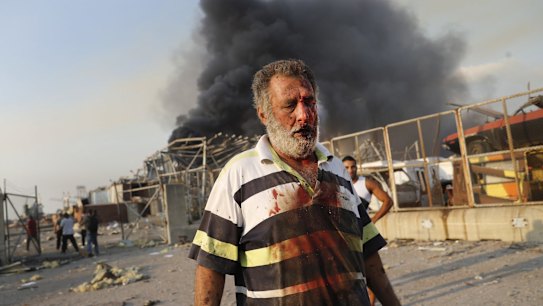 An injured worker walks at the explosion scene that hit the seaport of Beirut, Lebanon, Tuesday, Aug. 4, 2020. Massive explosions rocked downtown Beirut on Tuesday, flattening much of the port, damaging buildings and blowing out windows and doors as a giant mushroom cloud rose above the capital.   (AP Photo/Hussein Malla)