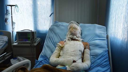 Abdulrahman Abdulaaly 18 lies in the ICU at the Athba Field Hospital where he is being treated for 60% burns to his body. Abdulrahman was being checked by Iraqi forces and doesn?t know if they were hit by an airstrike or a IS attack. Abdulrahman?s two brothers were killed in two seperate incidents in West Mosul under the Islamic State. 27th June, 2017. Photo: Kate Geraghty