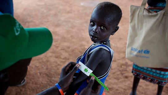 A boy has his arm measured to see if he is suffering from malnutrition.