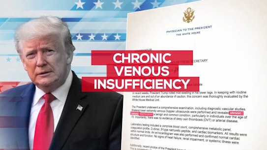 US President Donald Trump was examined for swelling in his legs and has been diagnosed with chronic venous insufficiency, the White House announced.