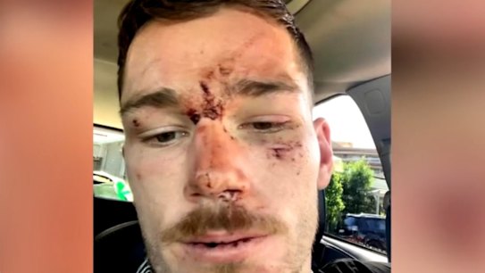 Rising Canberra Raiders NRL star Tom Starling has been charged with assaulting police during a brawl outside a bar on the NSW Central Coast.