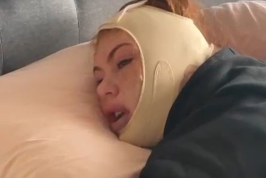 Ella Callis was hospitalised after her cosmetic surgery went horribly wrong.
