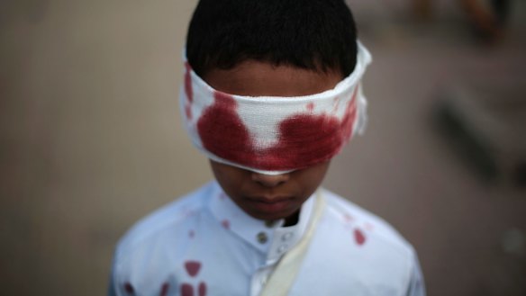A boy with fake blood on his face and clothes to represent a victim participates in a protest against Saudi-led airstrikes in Sanaa, Yemen, Sunday, Nov. 27, 2016. (AP Photo/Hani Mohammed)