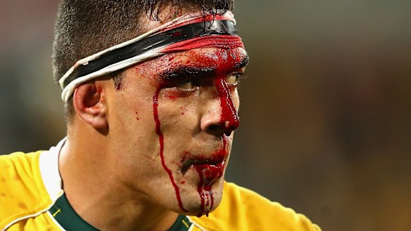 Split open: Wallabies forward Rory Arnold bleeds from his head during the Test between the Wallabies and England at AAMI Park.