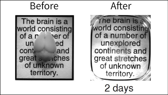 An intact adult mouse brain before and after the two-day CLARITY process.