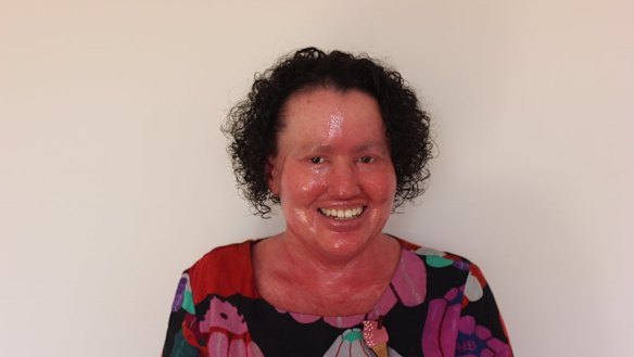 Writer and activist Carly Findlay