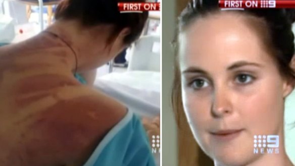 Lucky escape ... Erin Langworthy suffered only cuts and bruises.