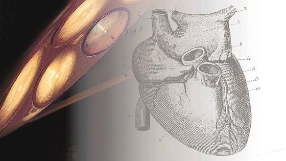 Left untreated, an abnormal immune reaction to Strep A infection of the skin and throat can have devastating consequences for the heart.