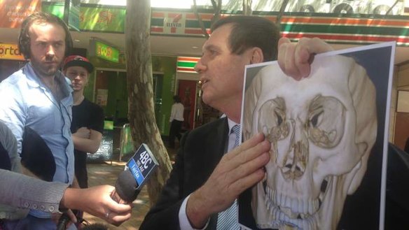 Doctor Anthony Lynham shows scans of an assault victim during a discussion about alcohol related violence.