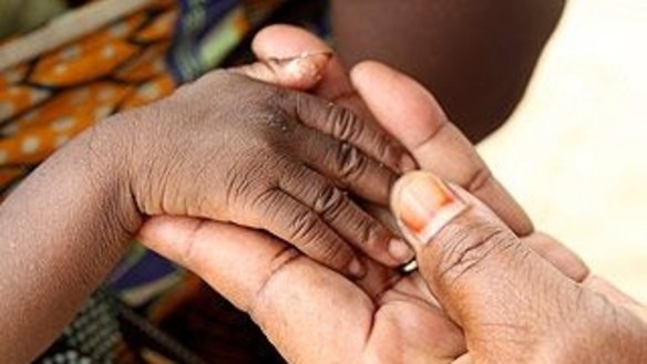 The cards quarantine 80 per cent of welfare payments in remote Aboriginal communities.