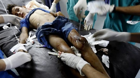 A wounded boy from the Bakr family, receives treatment at al-Shifa hospital, in Gaza City.
