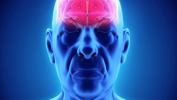 Health authorities fear the Strokecheck test does more harm than good.