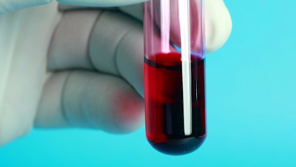 On Moday CSL, which creates vaccines and other products to prevent and treat life-threatening illnesses, saw its shares lift 1.73 per cent to $186.12.