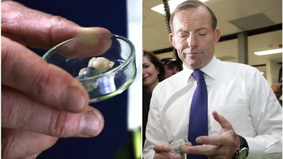 Opposition leader Tony Abbott inspects the brain of a mouse during his tour of the Queensland Brain Institute on Monday.