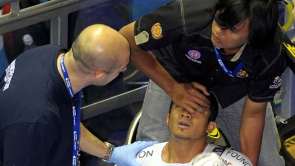 Malaysia cyclist has giant splinter removed from leg