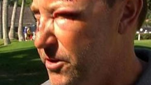 It has been a difficult year for Robert Allenby, who was attacked in Hawaii.
