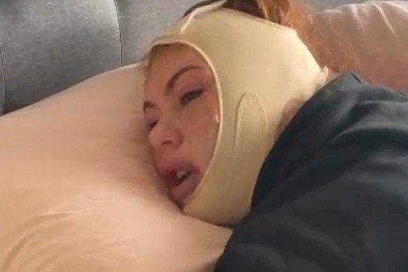 Ella Callis was hospitalised after her cosmetic surgery went horribly wrong.
