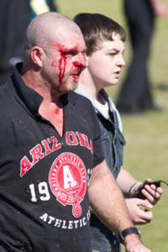 New laws urged as spectators join the fight