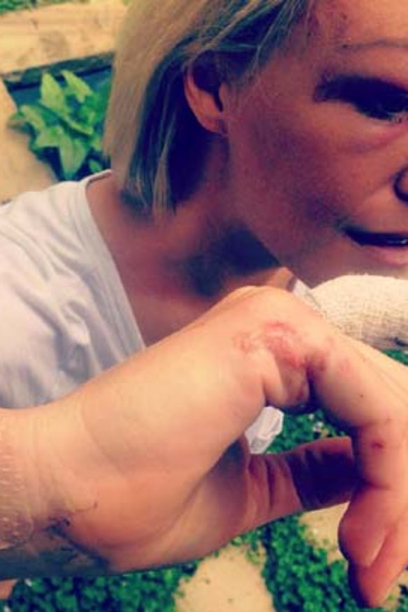 Several days after the accident.