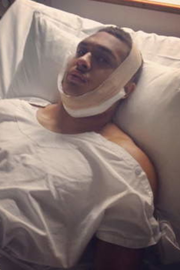 Black Knights say severity of injury swayed Snowden ban